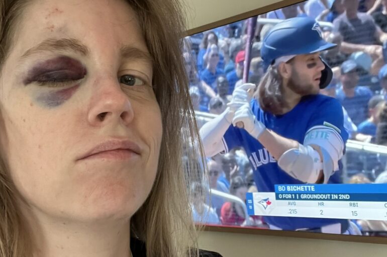 Bo Bichettye fastball off the face