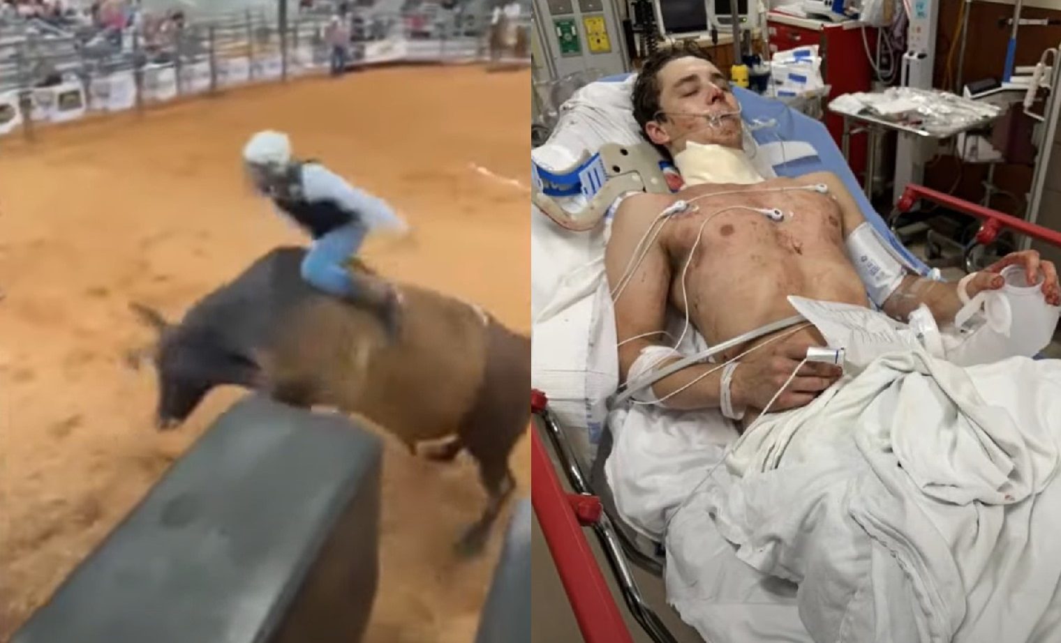 24-Year-Old Bull Rider Cheats Death After Being Gored In the Neck ...
