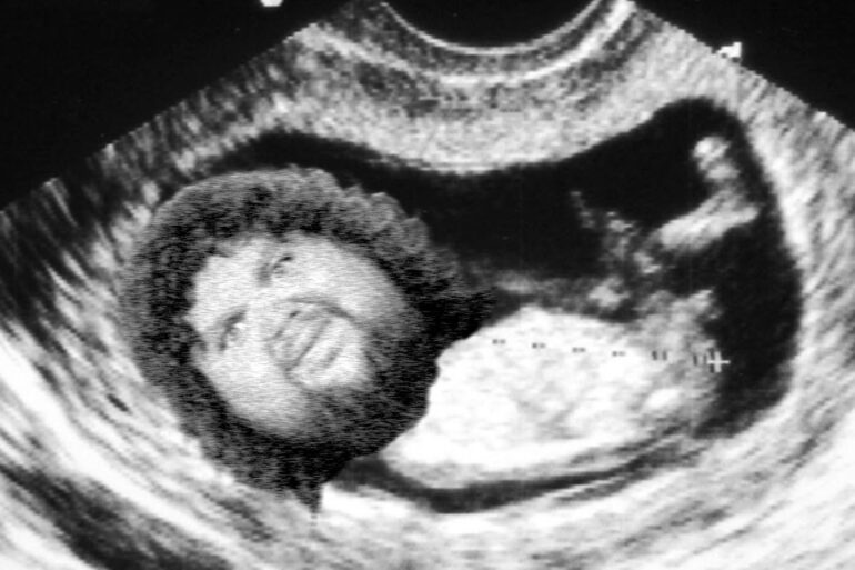 JD Vance ultrasound meme