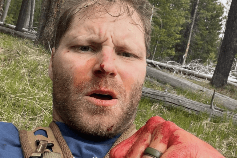 Hiker bear attack