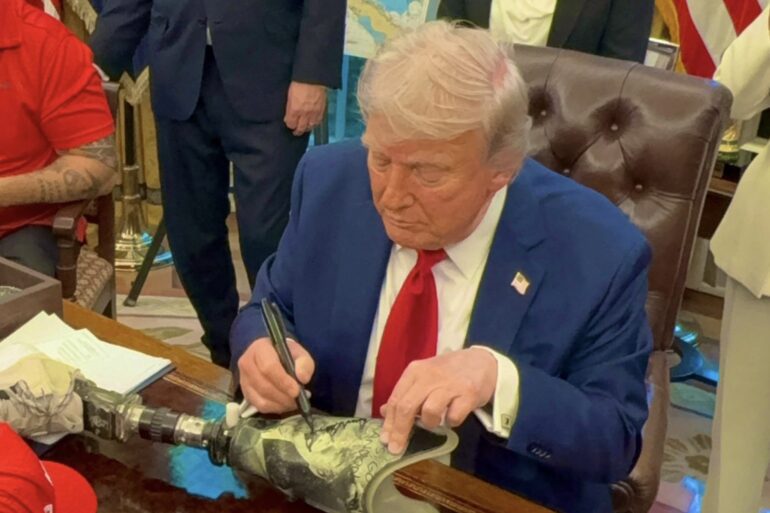 Donald Trump signs prosthetic leg